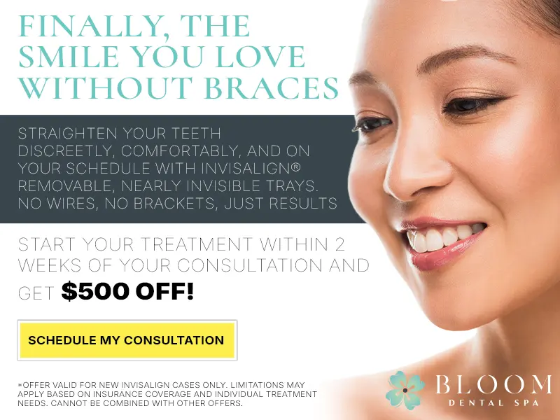 Invisalign Promotion