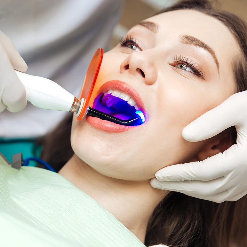 Woman undergoing dental procedure using a curing light, with a bright blue light being applied to her teeth. A gloved dental professional holds the device, which includes an orange protective shield. The patient is wearing a green dental bib and appears relaxed.
