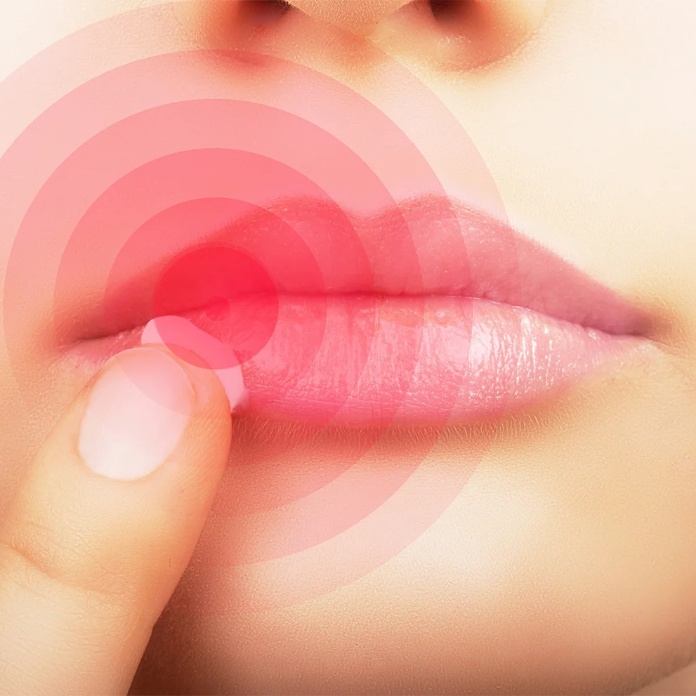 Close-up of a person’s lips with a red circular pain indicator and a finger touching the lower lip, suggesting irritation or a cold sore. The image highlights localized discomfort around the mouth area.