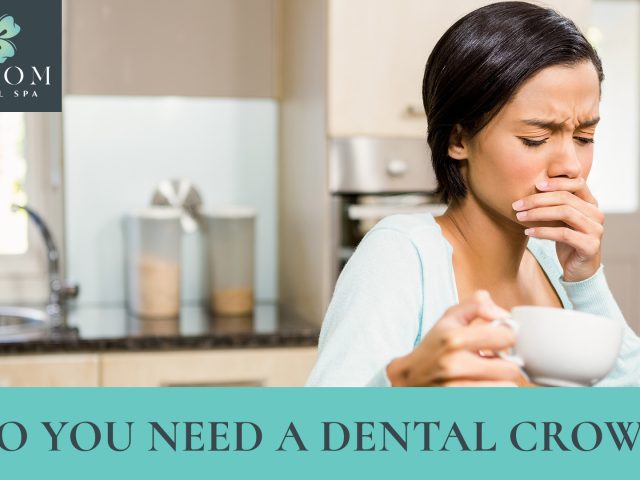 Do You Need a Dental Crown? Signs and Solutions (featured image)
