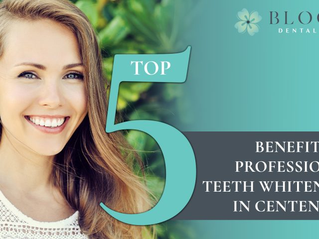 Top 5 Benefits of Professional Teeth Whitening in Centennial (featured image)