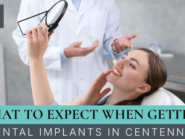 What to Expect When Getting Dental Implants in Centennial (featured image)