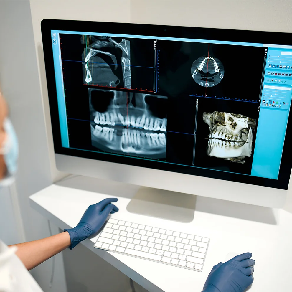 Dental professional wearing gloves reviewing digital dental X-rays on a large computer screen, including panoramic and 3D views of a patient’s jaw and teeth.